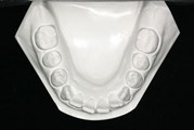 mandibular